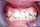 Orthodontie behandeling